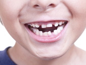 Детские зубные аномалии